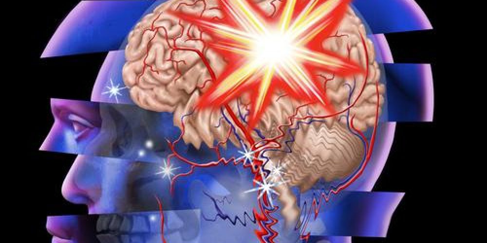 traumatic-brain-injury-3